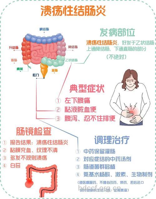 如何诊断溃疡性结肠炎?