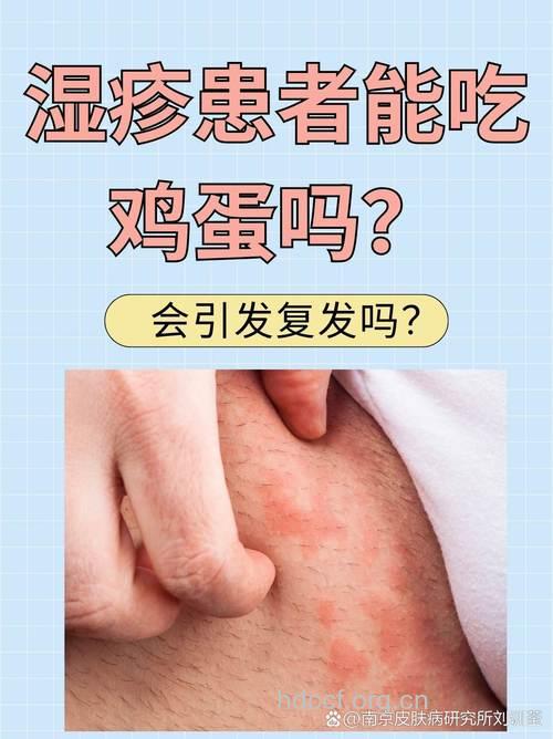 秋冬湿疹干性更严重 吃蛋黄防湿疹
