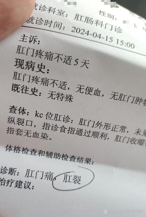 陈旧性肛裂诊疗病例
