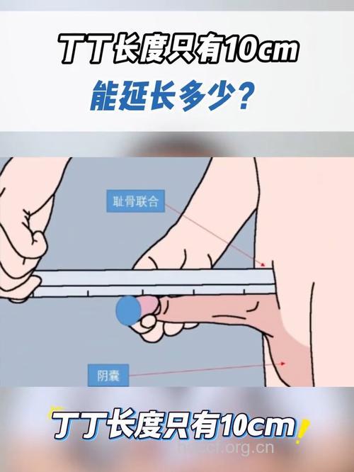 男性怎么判断阴茎短小