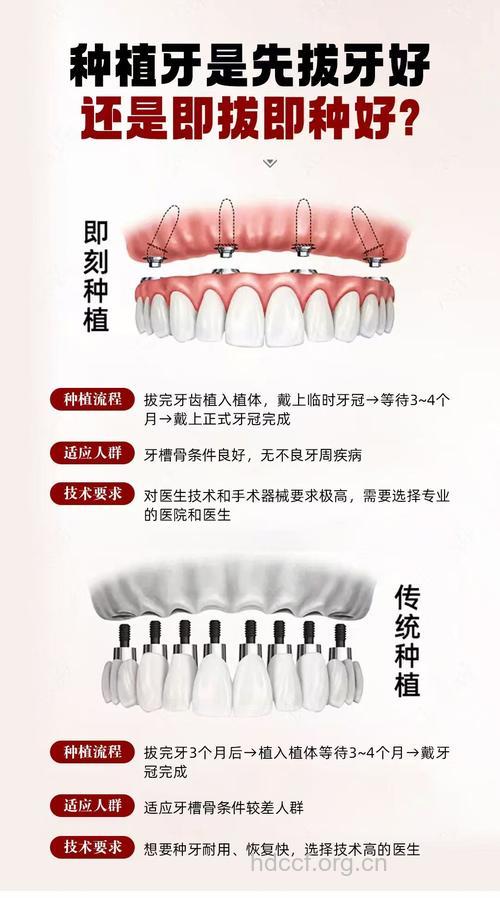 患者热捧口腔种植技术,成新选择
