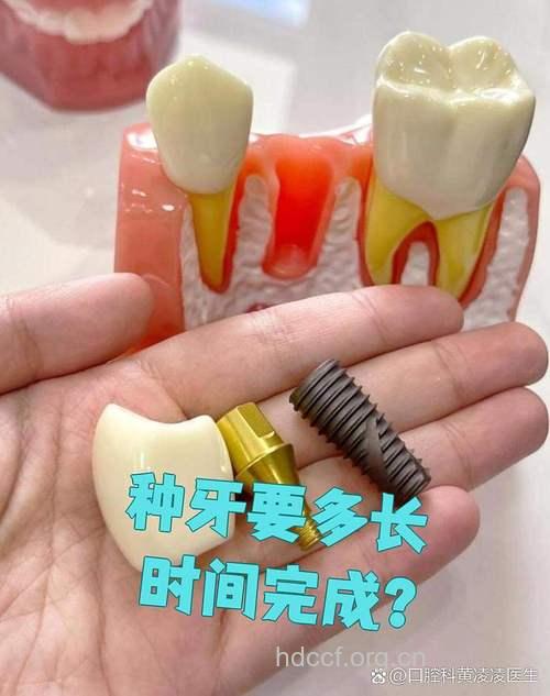 替自己种颗牙