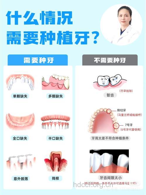 牙齿缺失者的首选是种植牙