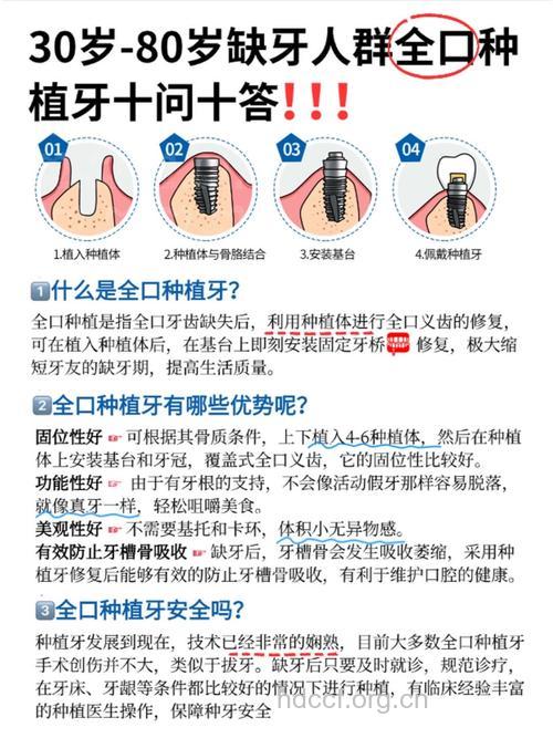 关于种植牙的求诊解惑