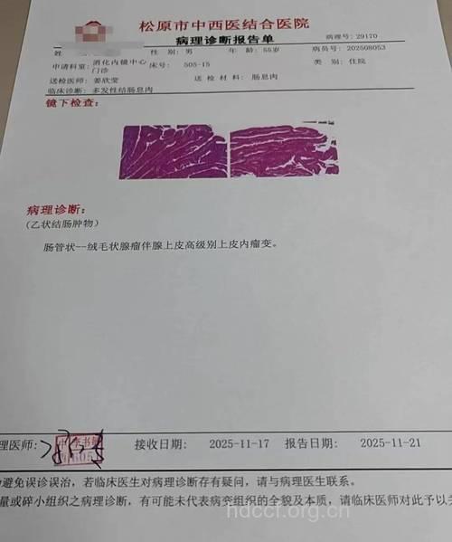 一则直肠息肉切除术的病例