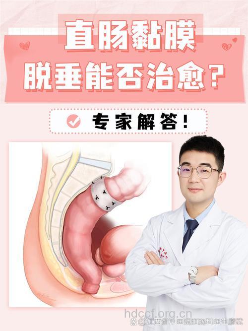 中医可治愈直肠脱垂