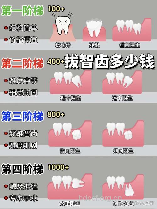 智齿一次能拔几颗