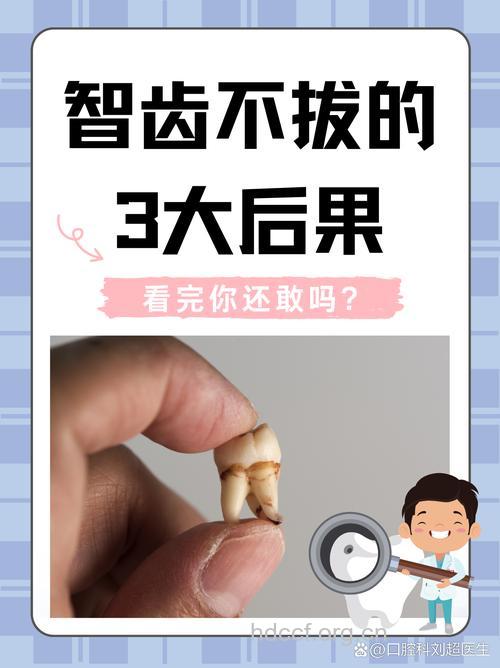美国18岁少年拔智齿丧命 智齿到底该不该拔