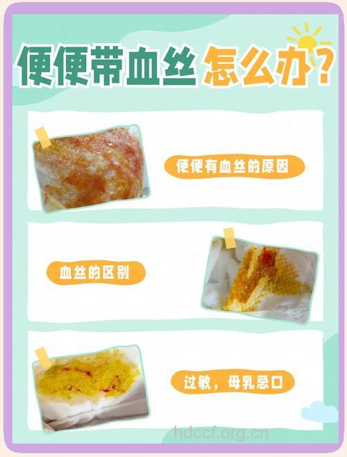 宝宝便血是怎么一回事