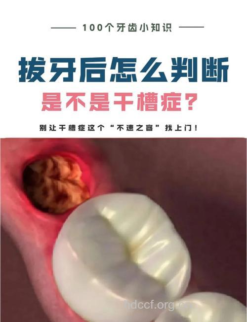 拔牙后有什么并发症