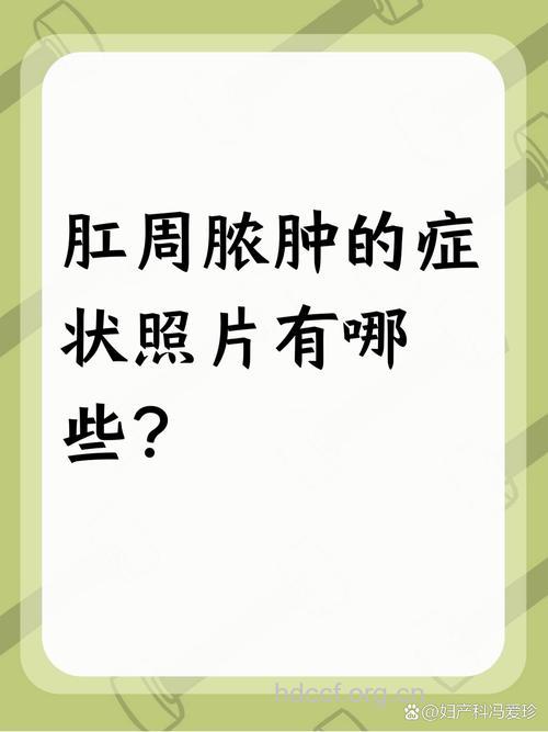 湿热天气肛周脓肿患者增多