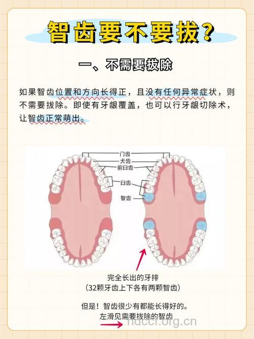 哪些智齿不需要拔除