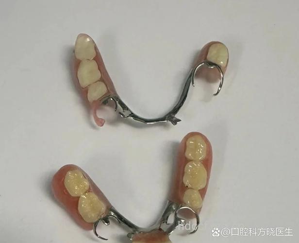 “按扣”让假牙严丝合缝