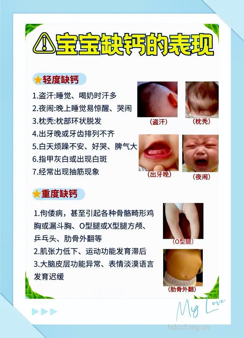 有哪些预防婴幼儿缺钙措施