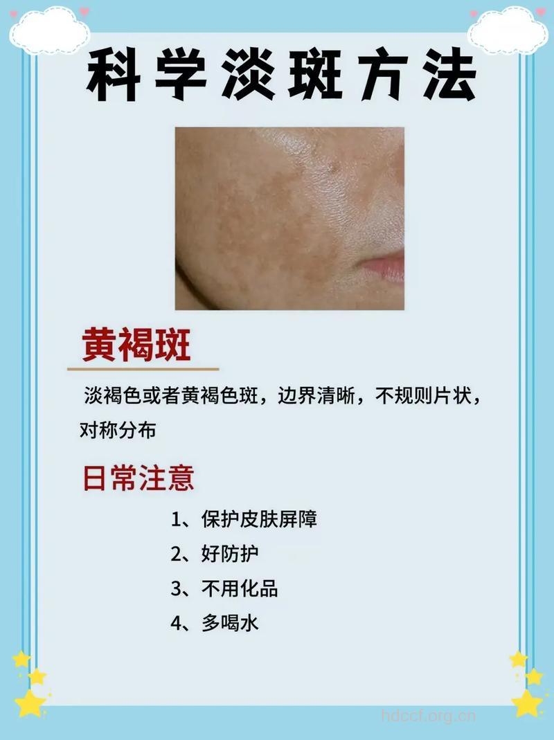 白领丽人有哪些淡斑方法
