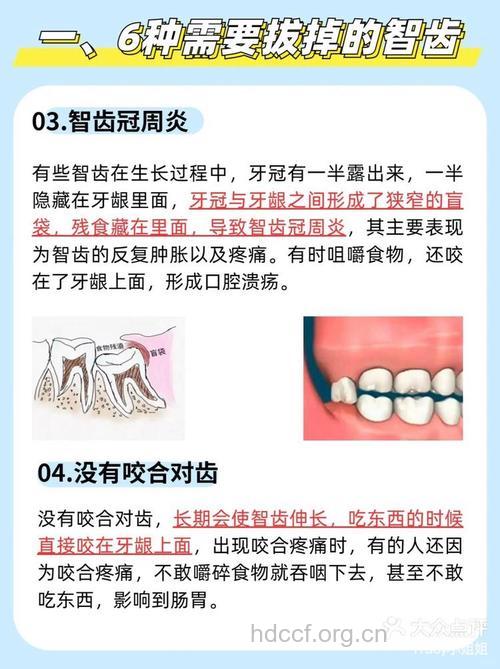 8类牙齿不得不拔