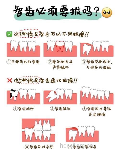哪些人不适合拔牙呢？