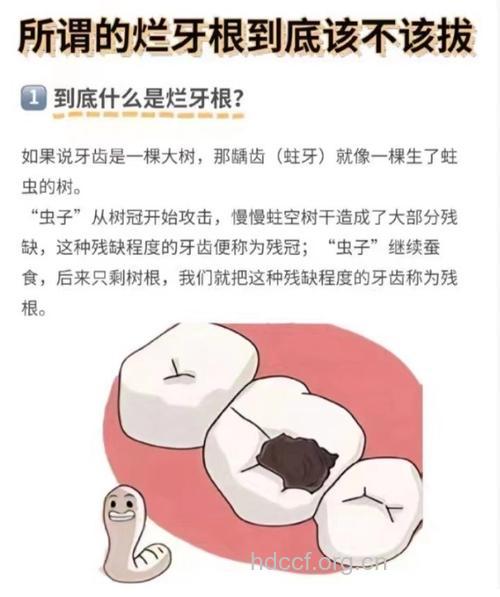 牙齿坏了，不要急着拔