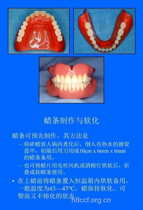 怎样让假牙严丝合缝?