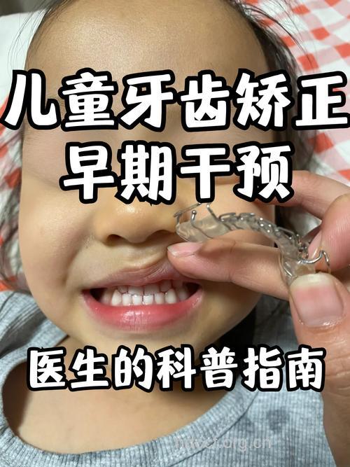 小儿正畸不拔牙,可以吗?