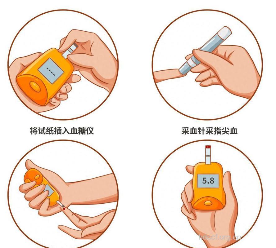 糖尿病人血糖监测五个点