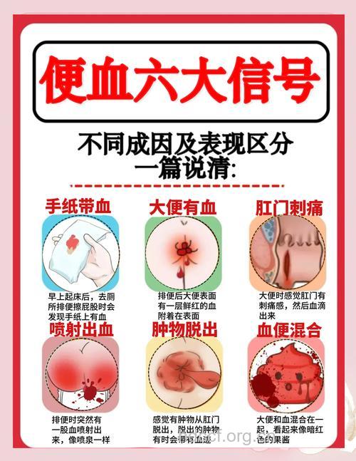 导致便血的原因是什么呢