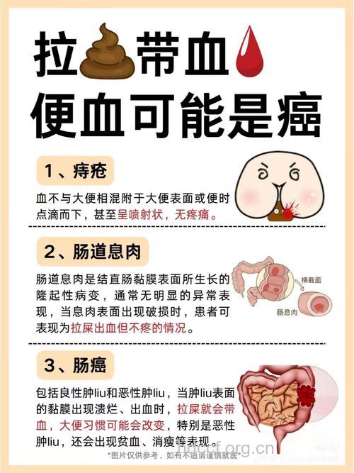 男性便血是什么原因引起的