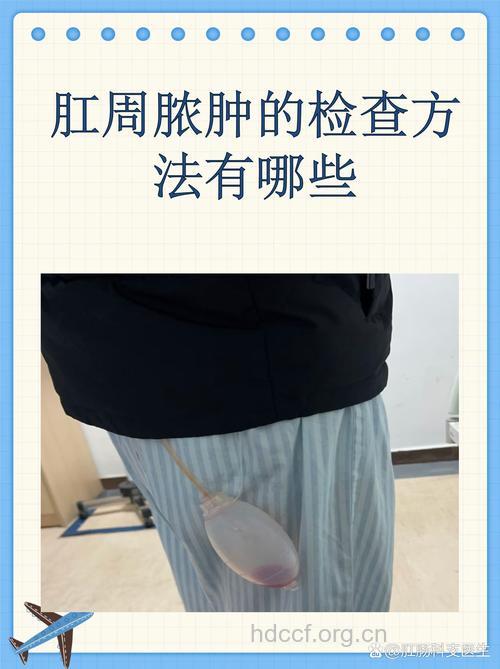 肛周脓肿的常规检查诊断方法有哪些
