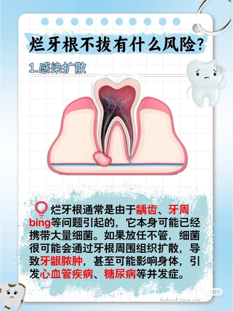 烂牙应尽早拔除,久了小心会癌变