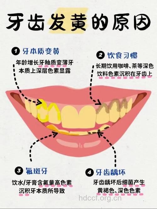 导致牙齿变色的六种疾病