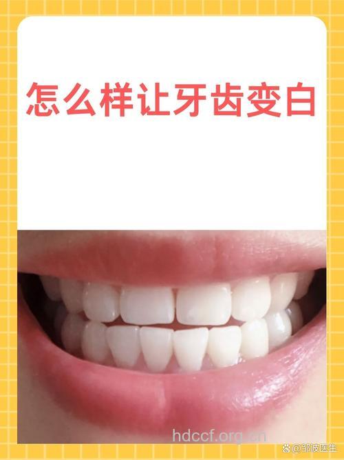 六大方法帮你牙齿靓白