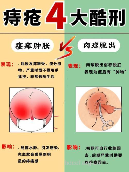6个坏习惯让你屁股长痔疮