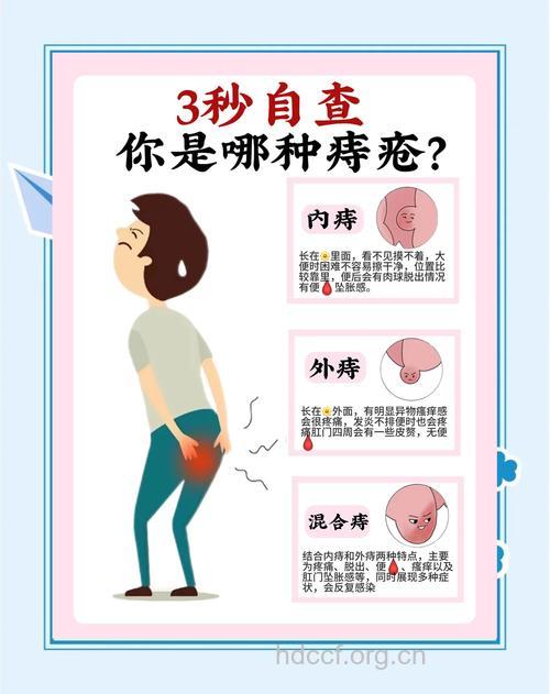 痔疮初期的多个症状表现
