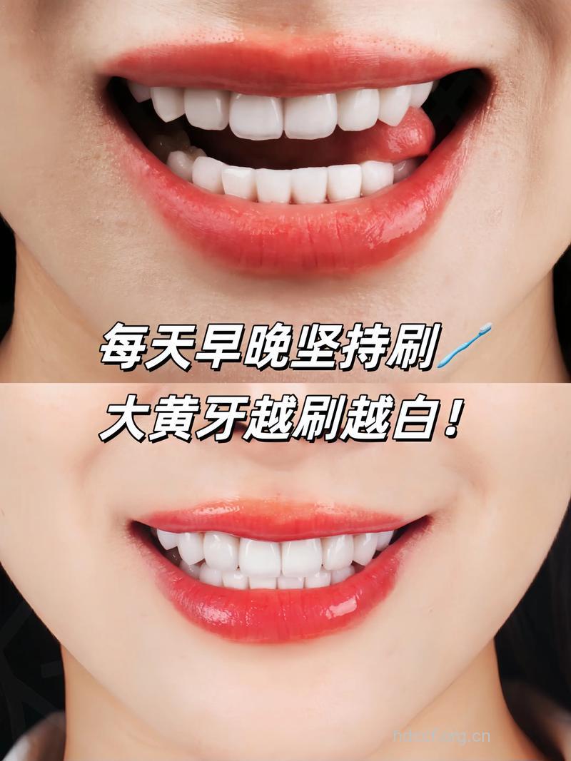 美白特效牙膏会损害牙齿吗