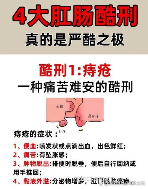 夏季多发痔疮 揪出幕后“元凶”