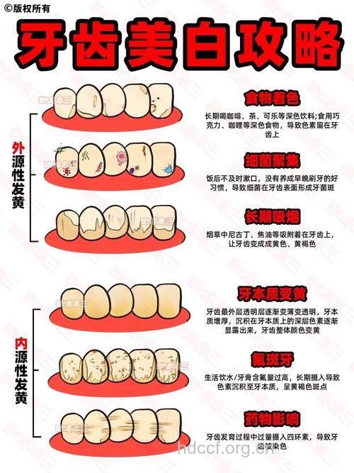 几种牙齿美白方法的优劣