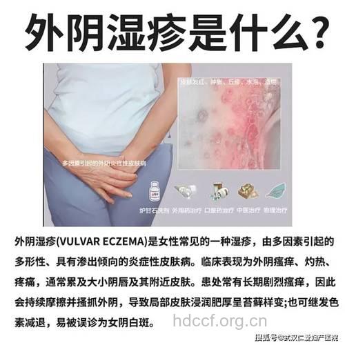 外阴湿疹是否容易导致瘙痒吗