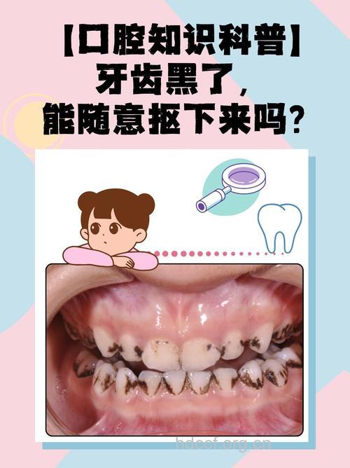 为什么牙齿会变黑