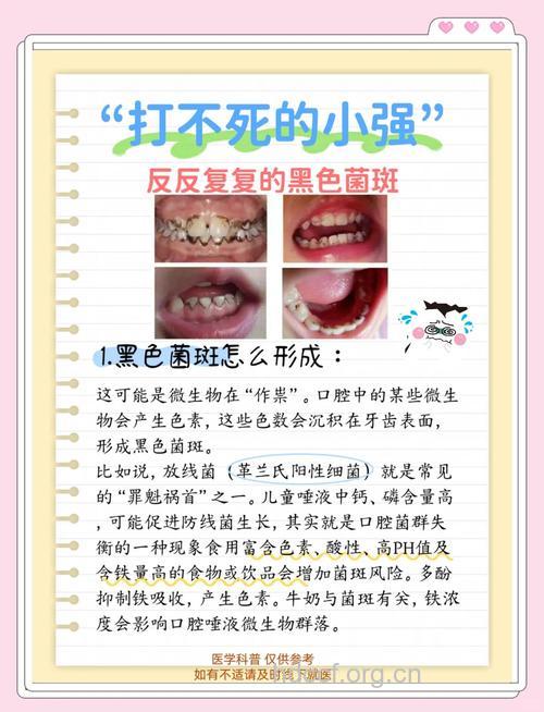 牙齿变黑的3个常见原因