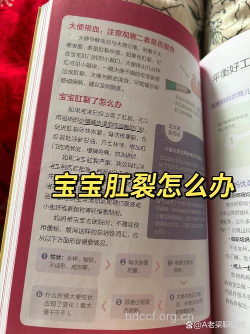 孩子患上肛裂后要注意哪些事项