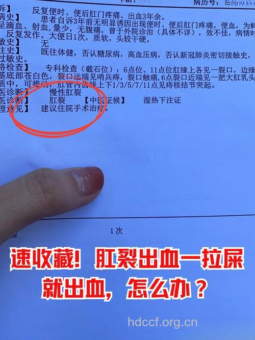 警惕!大便后带血或是肛裂引起