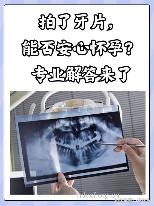 怀孕切忌拍牙片