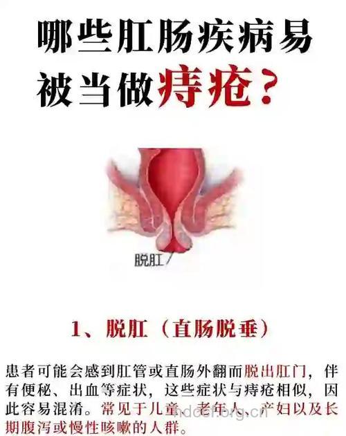 肛痿形成的四个阶段