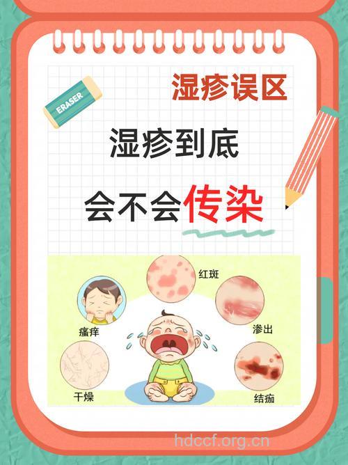 湿疹患者容易犯的误区