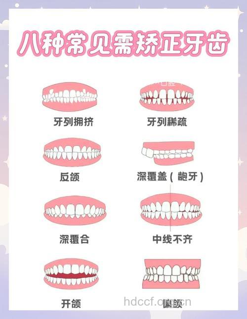 准妈妈会遇到的牙齿问题