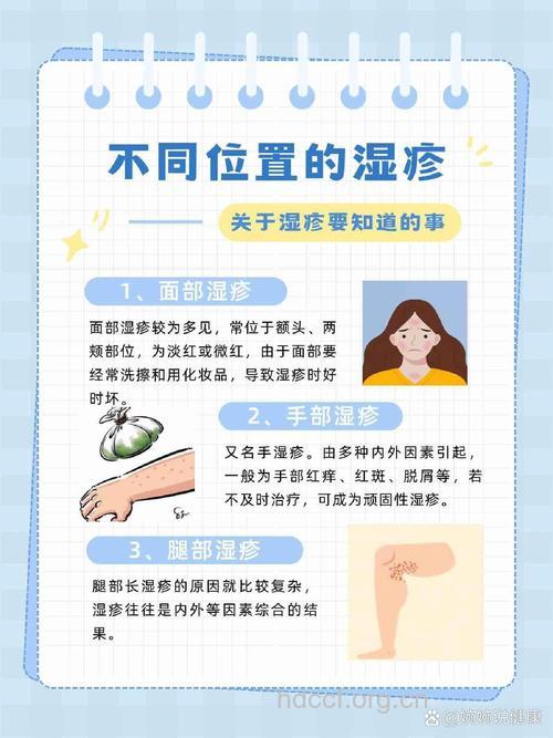 湿疹爱长在哪里？