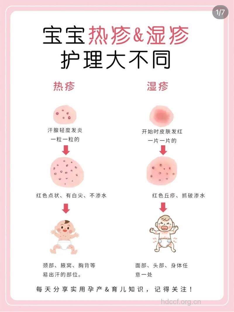 如何判断宝宝的湿疹是哪一类型的？