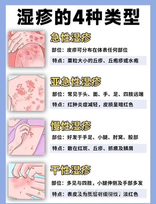 湿疹是如何引起的？该怎么办？