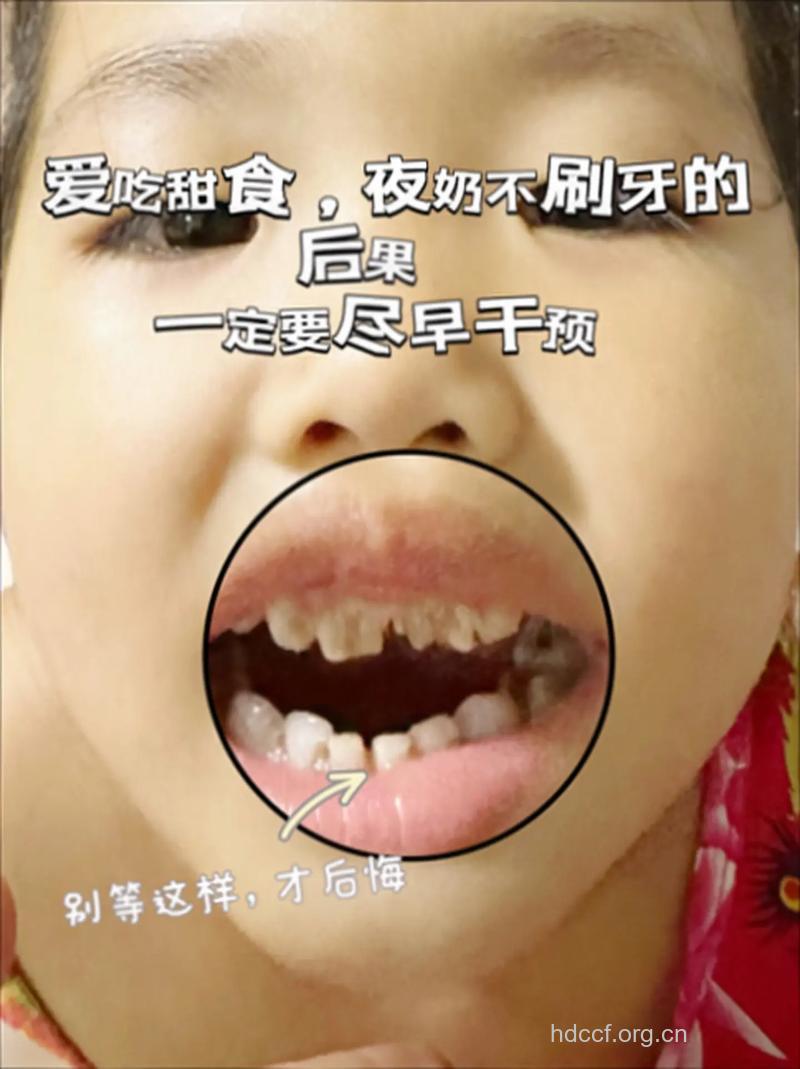 这些小习惯会损害宝宝的牙齿