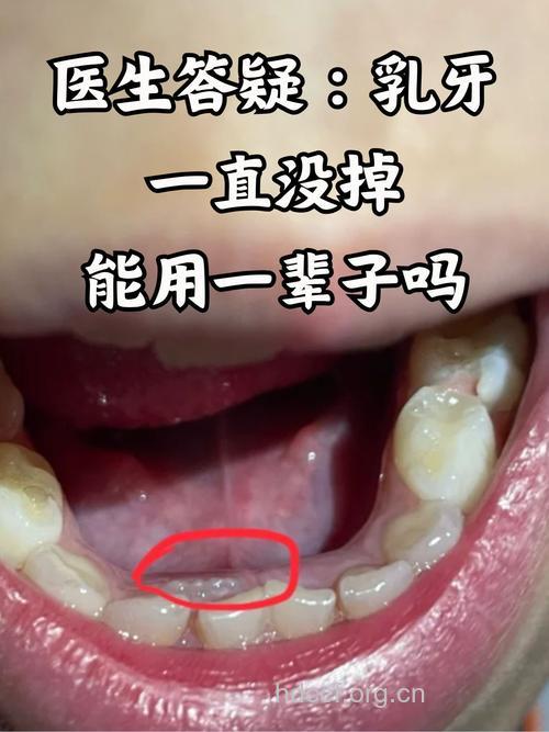 乳齿冒出时就应看牙医